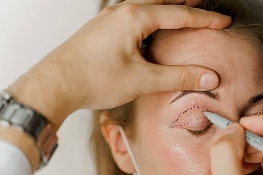 A Closer Look at Eyelid Surgery