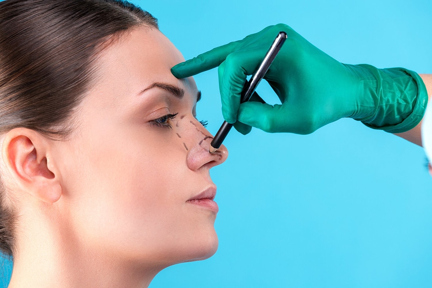 Nasal Tip Refinement for a Natural Rhinoplasty Outcome