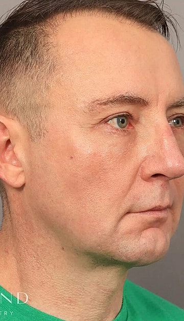 Profile view of man with short hair.