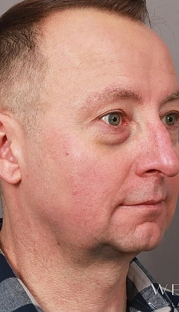 Side profile of a man with light skin.