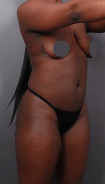 Before and after body image comparison.