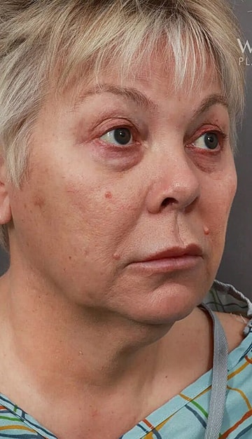 Woman with short blonde hair, neutral expression.