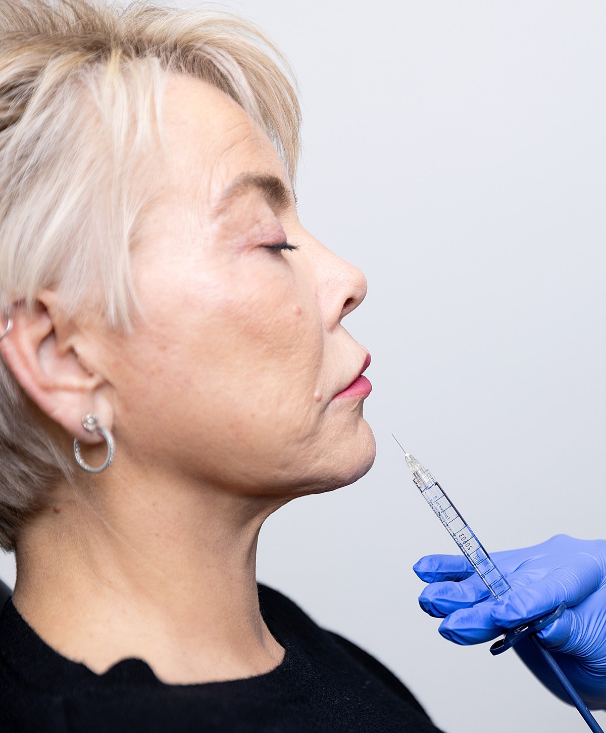 Botox injection procedure on a woman's face.