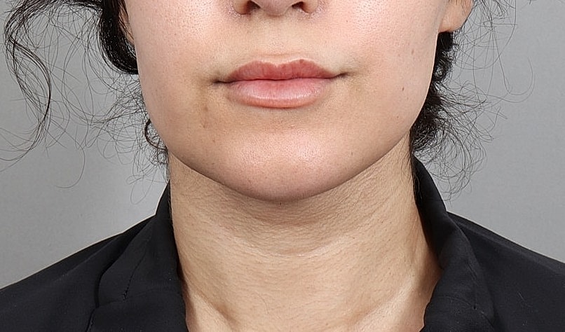 Close-up of a person's chin and lips.