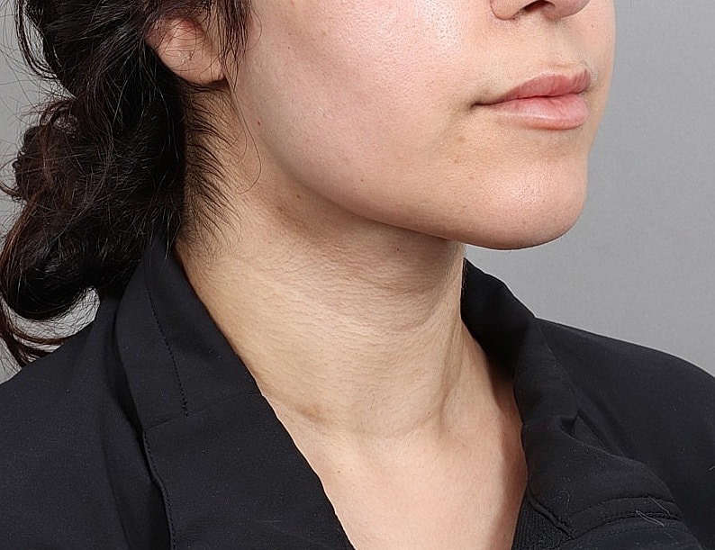 Profile view of a woman with light skin.