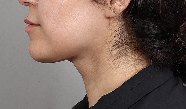 Profile view of a woman smiling.