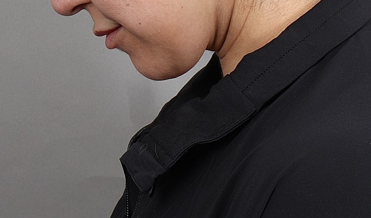 Profile view of a woman in a dark jacket.