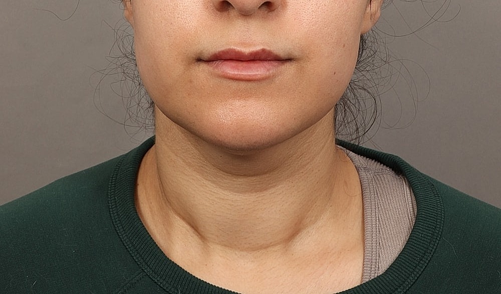 Close-up of a person's neck and chin.