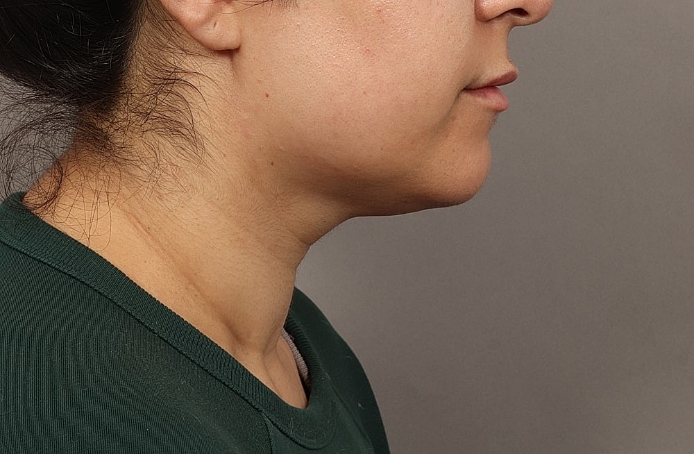 Profile view of a woman with dark hair