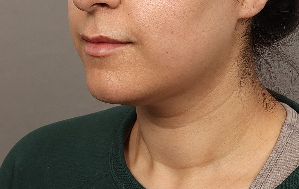 Close-up of a woman's lower face.