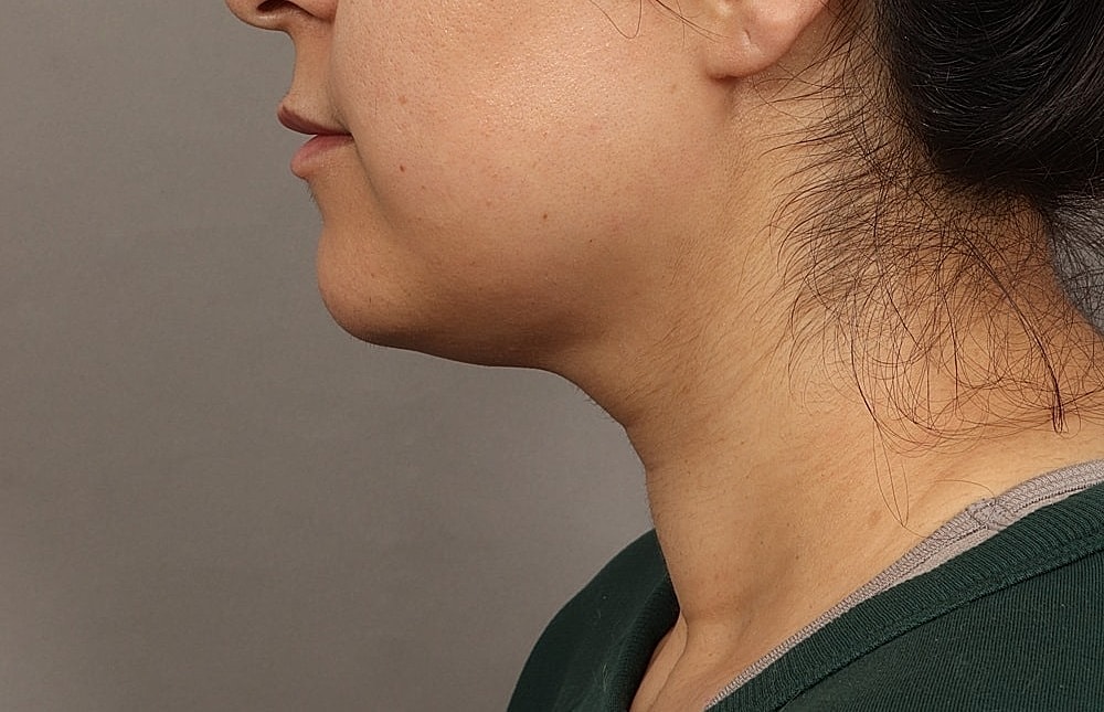 Profile view of a woman’s face.
