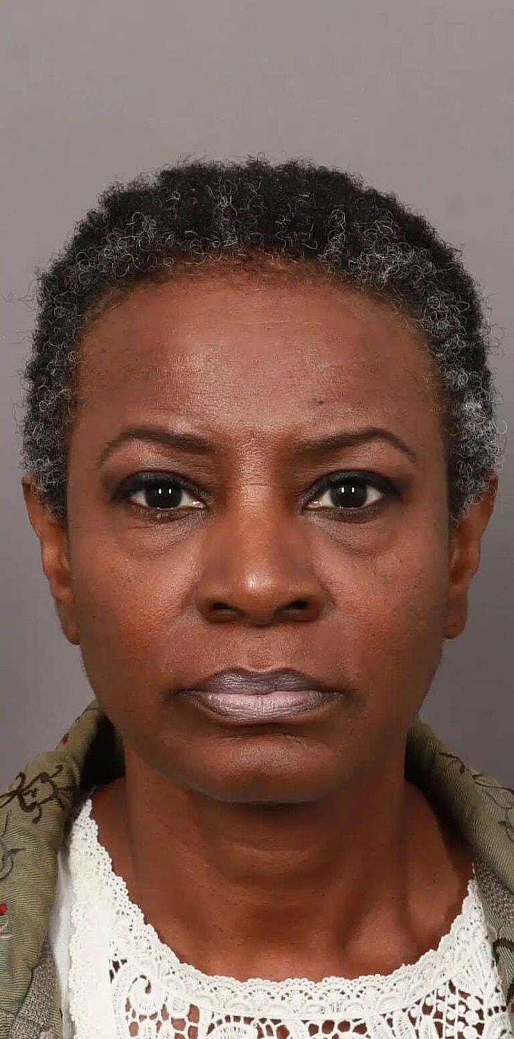 Hair Restoration Before & After