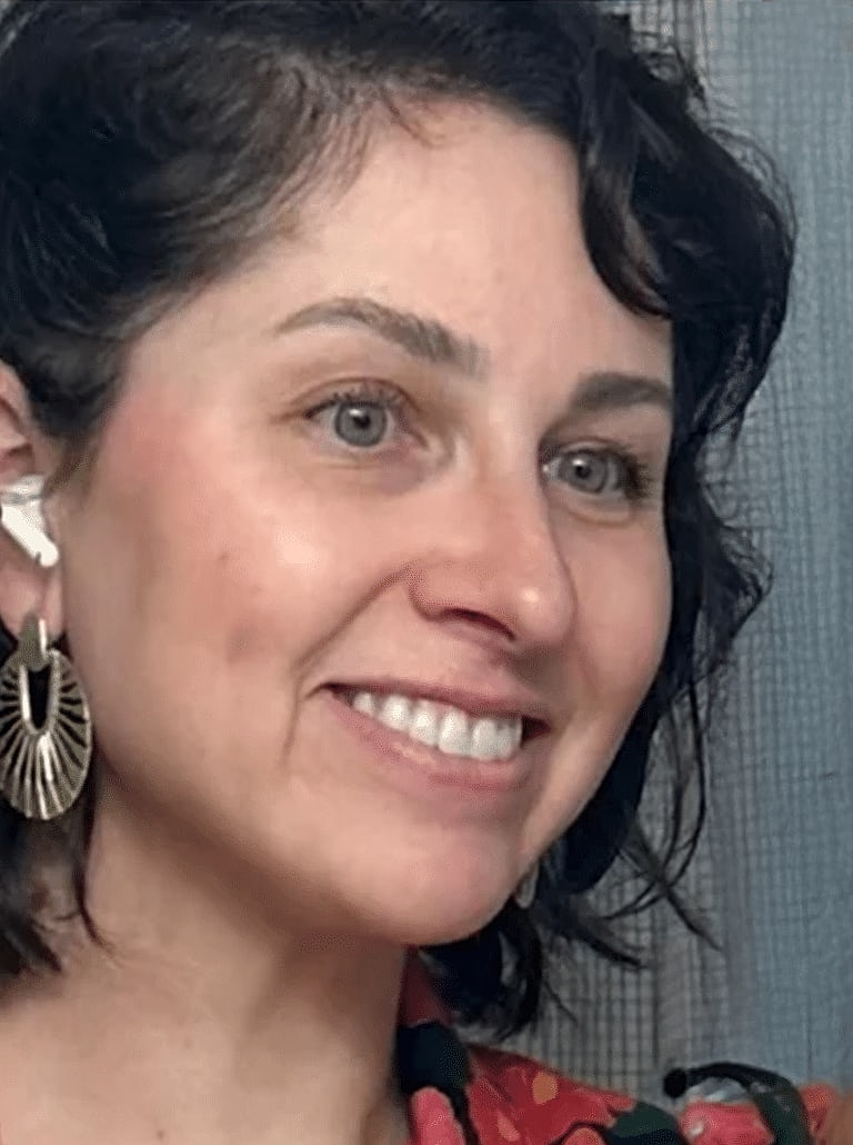 Renuvion Before & After