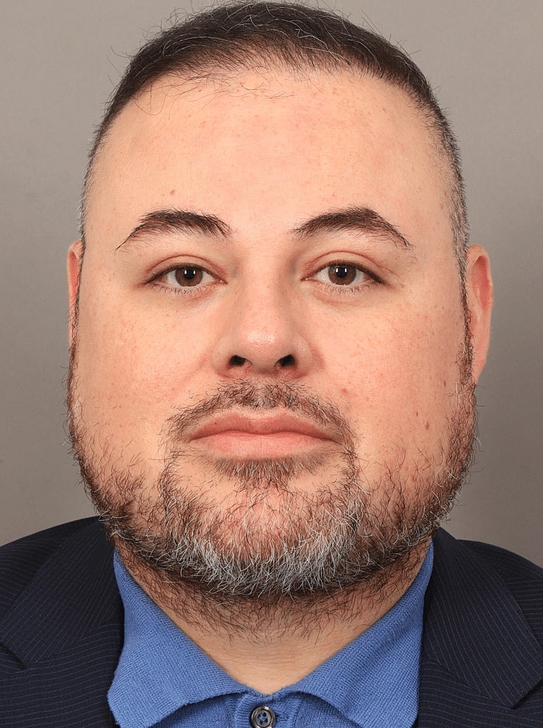 Renuvion Before & After