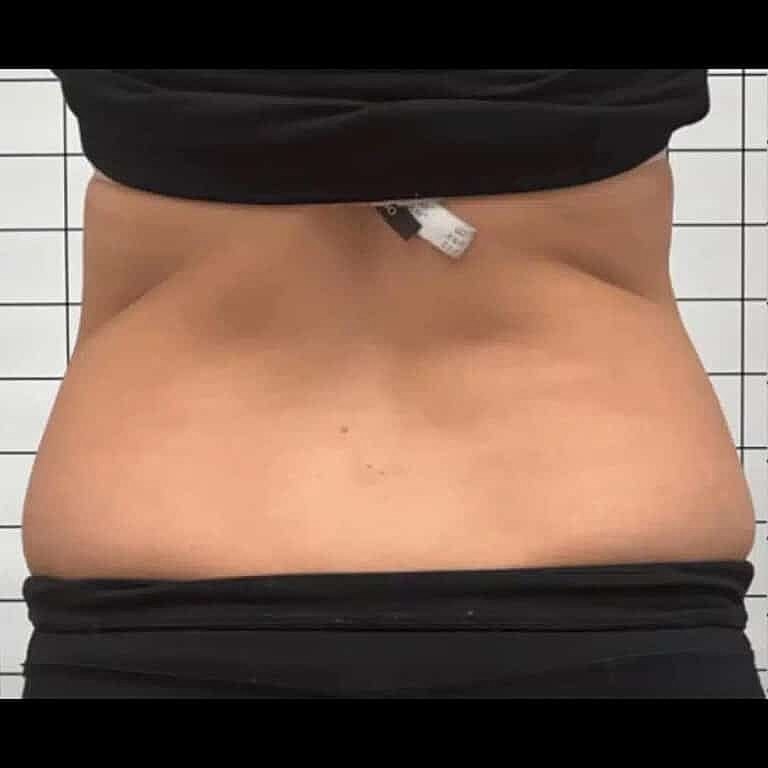 Physiq Before & After