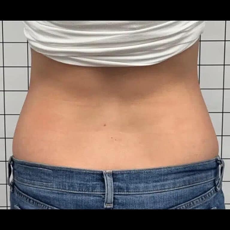 Physiq Before & After