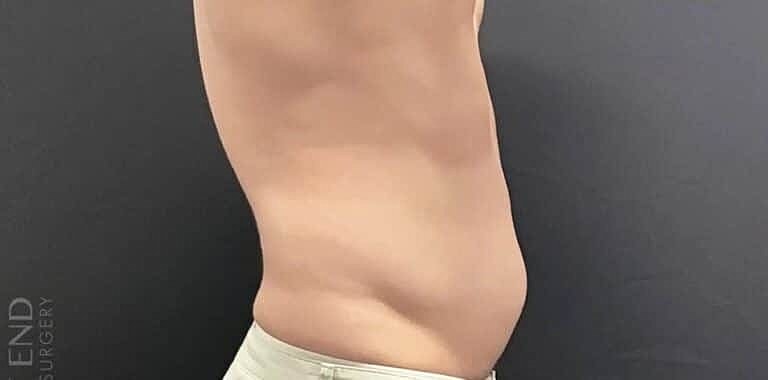 Physiq Before & After