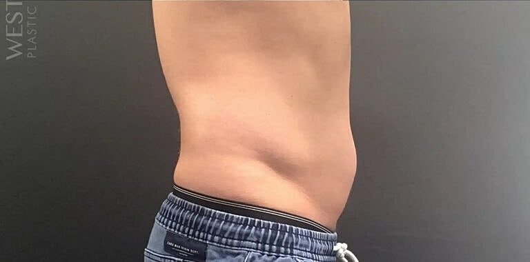 Physiq Before & After