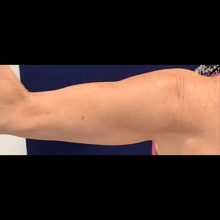 Physiq Before & After