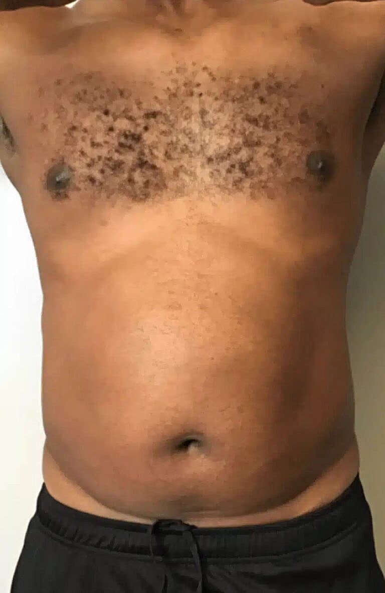 Physiq Before & After