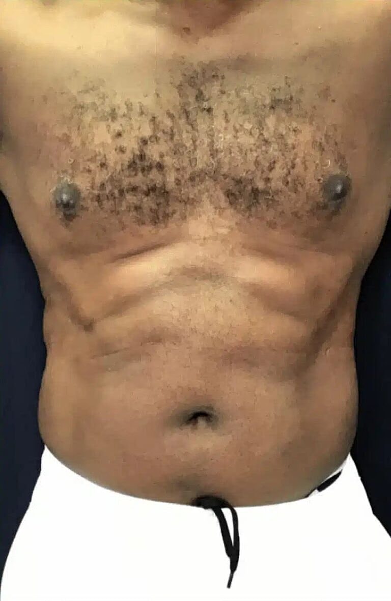 Physiq Before & After