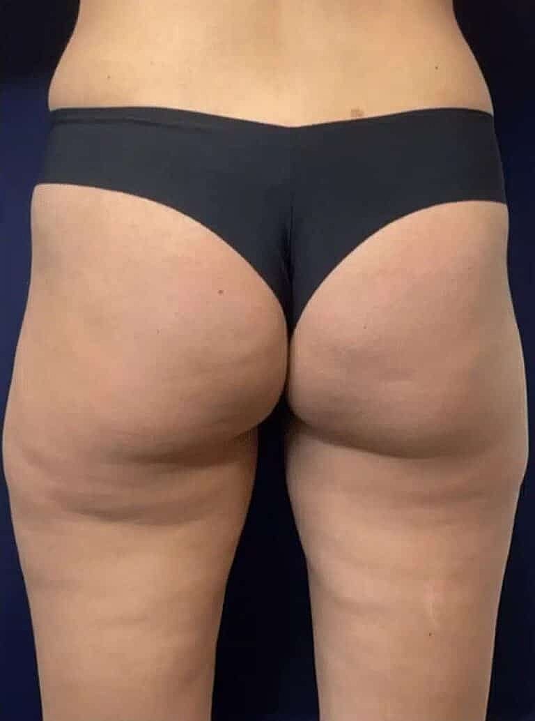 Physiq Before & After