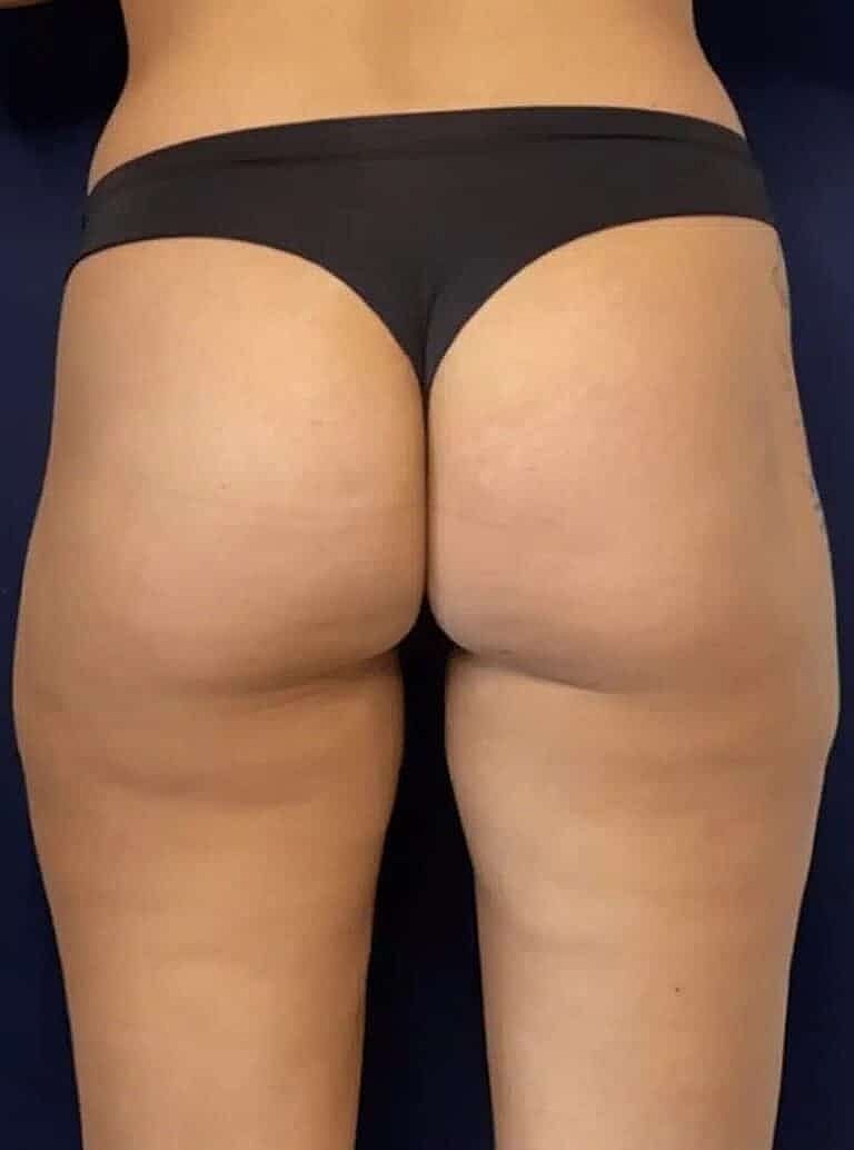 Physiq Before & After