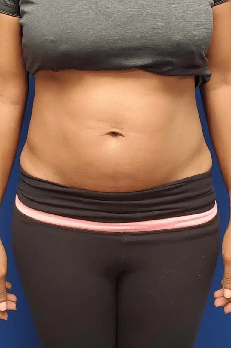 Physiq Before & After