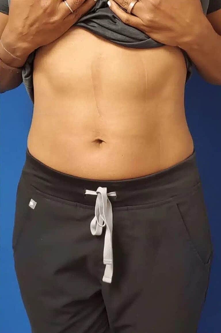 Physiq Before & After