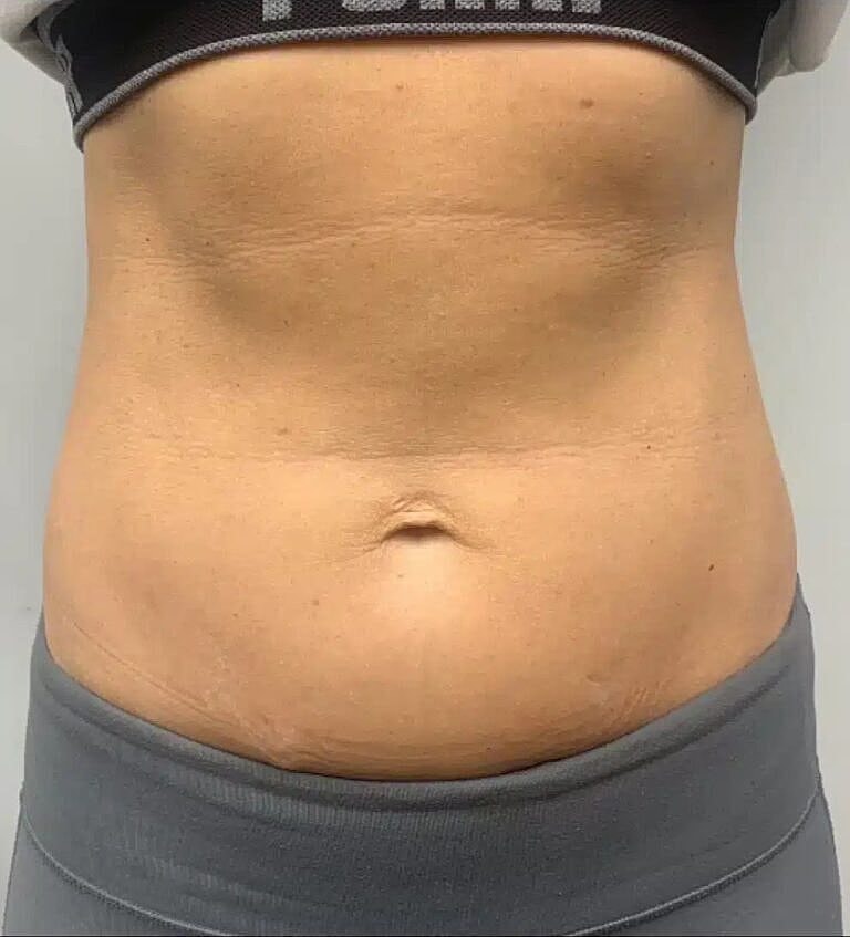 Physiq Before & After