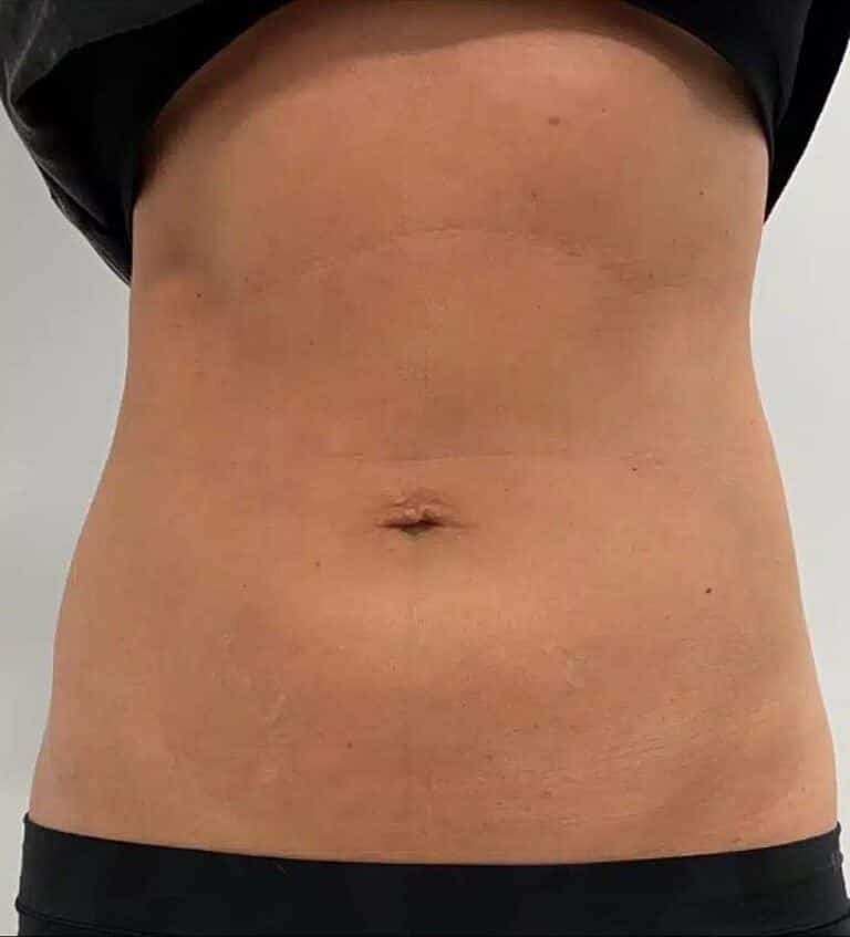 Physiq Before & After