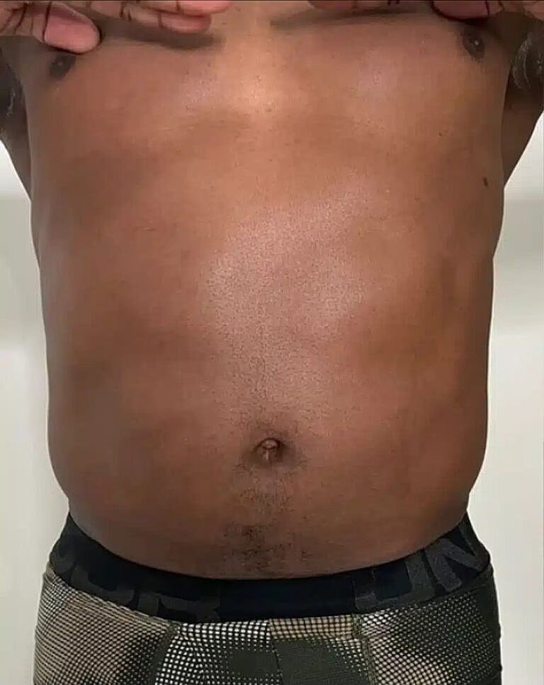 Physiq Before & After