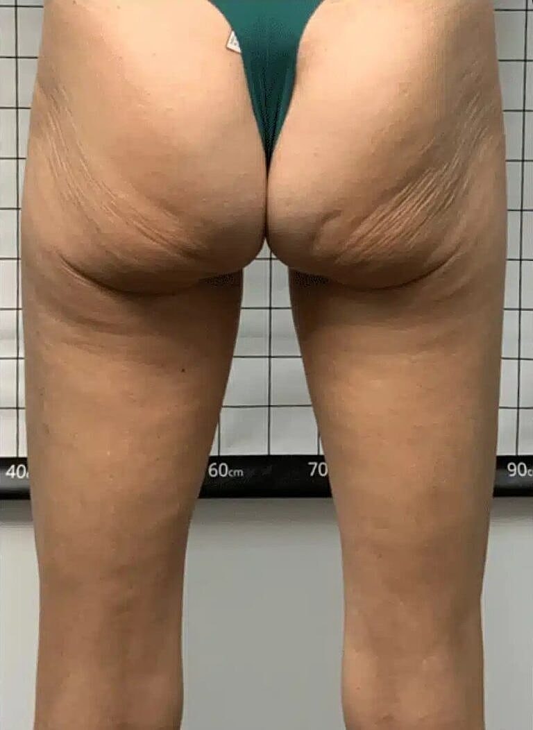 Physiq Before & After