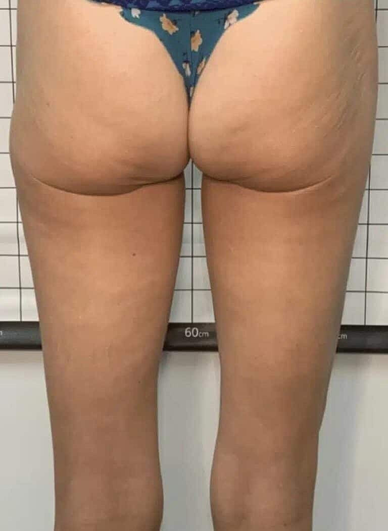 Physiq Before & After