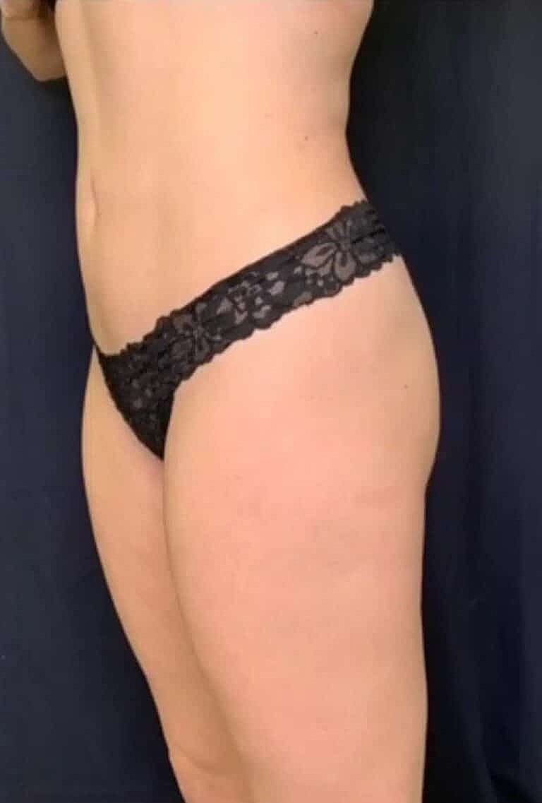 Physiq Before & After