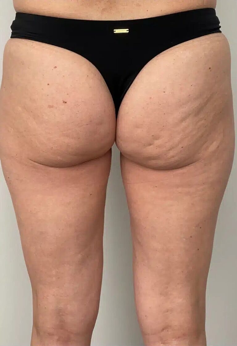 Physiq Before & After