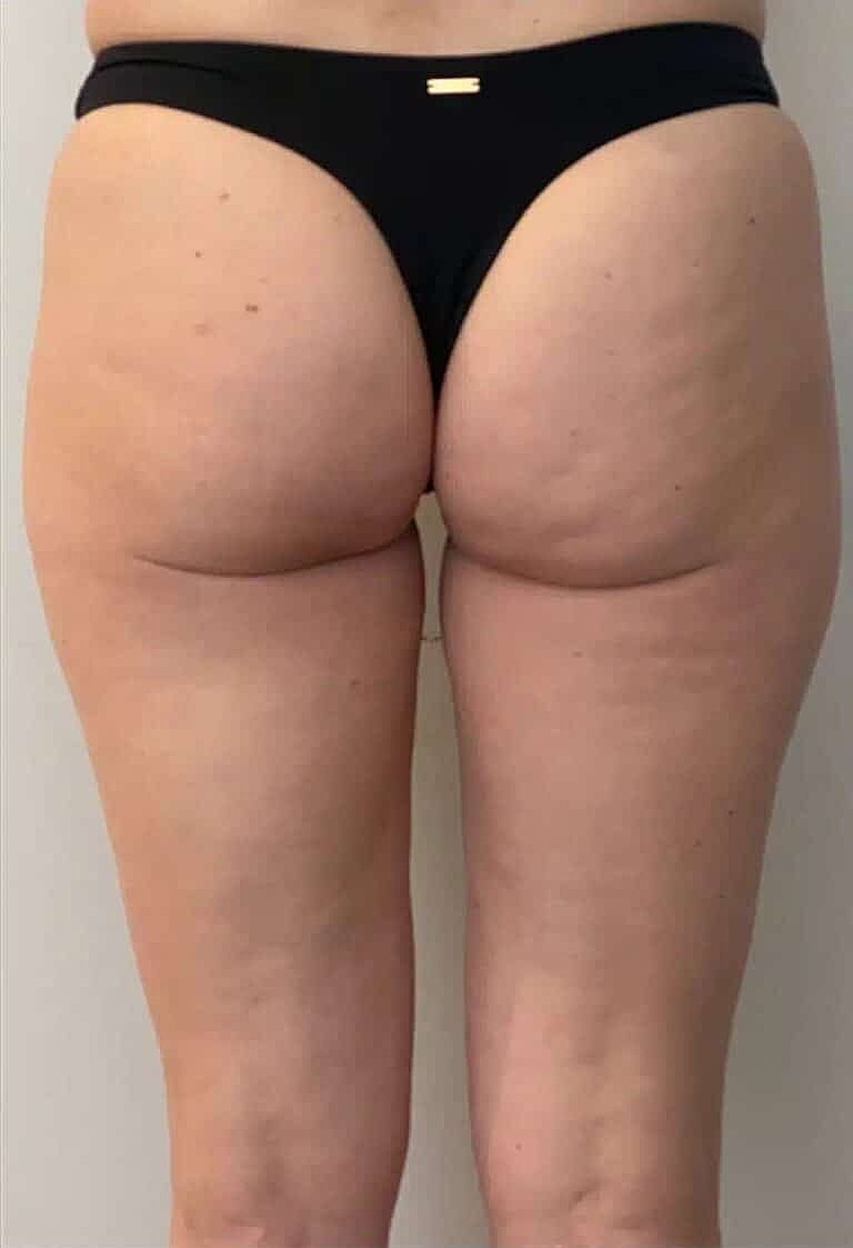 Physiq Before & After