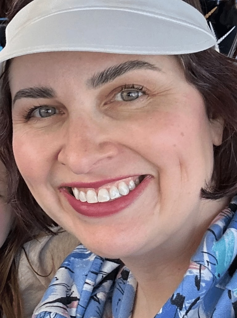 Face Liposuction Before & After