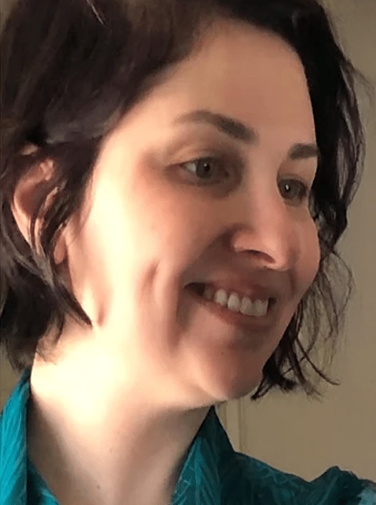 Face Liposuction Before & After