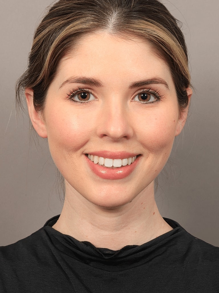 Face Liposuction Before & After