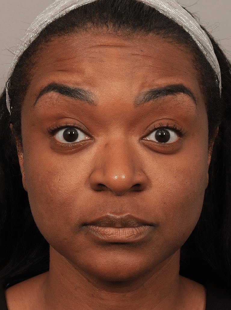 Neurotoxins Before & After