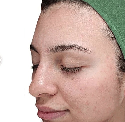 After Image of VI Peel Washington DC