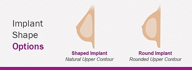 Implant shape options: shaped vs. round.