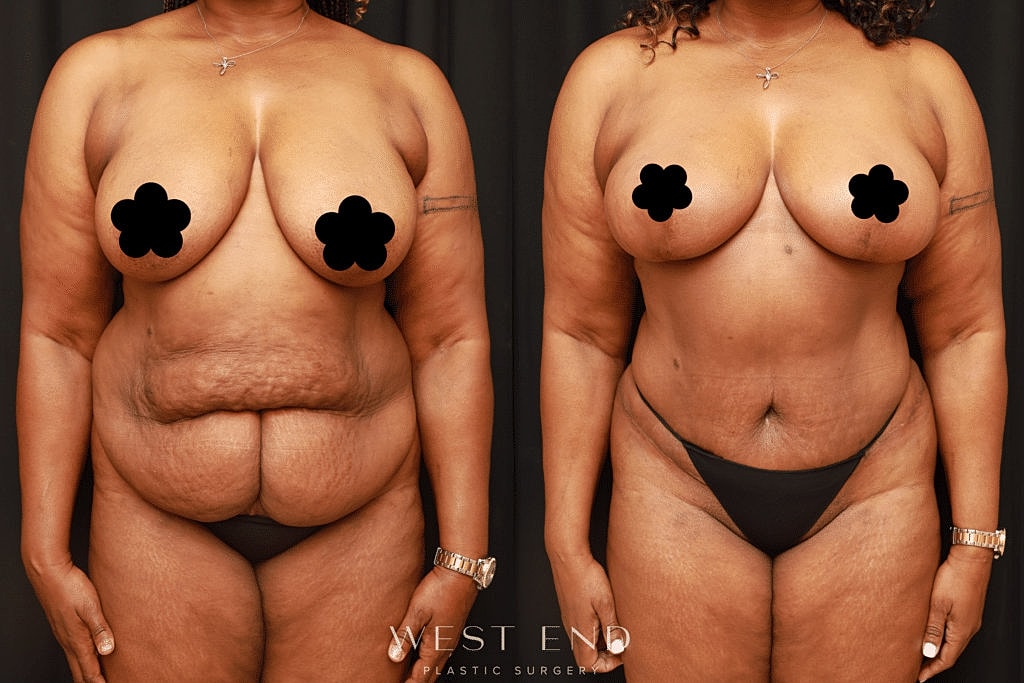 Before and after body transformation images.