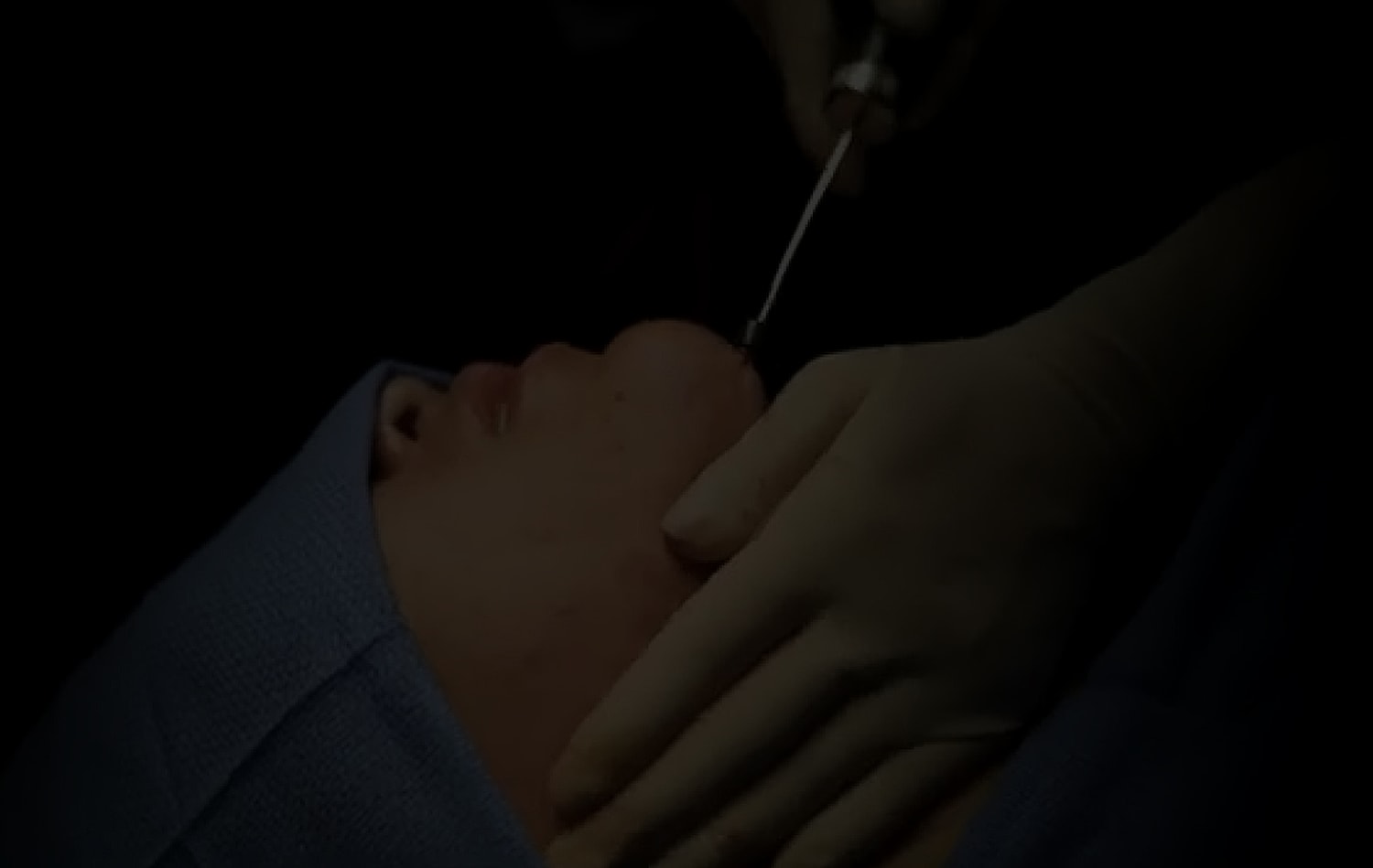 Medical procedure focused on facial treatment.