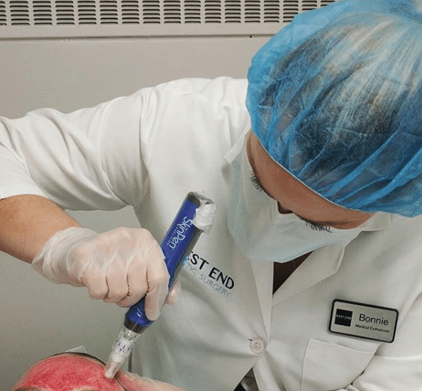 Microneedling Washington D.C. Microneedling Washington D.C.