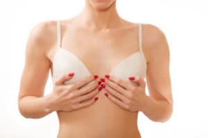 breast augmentation west end plastic surgery washington dc