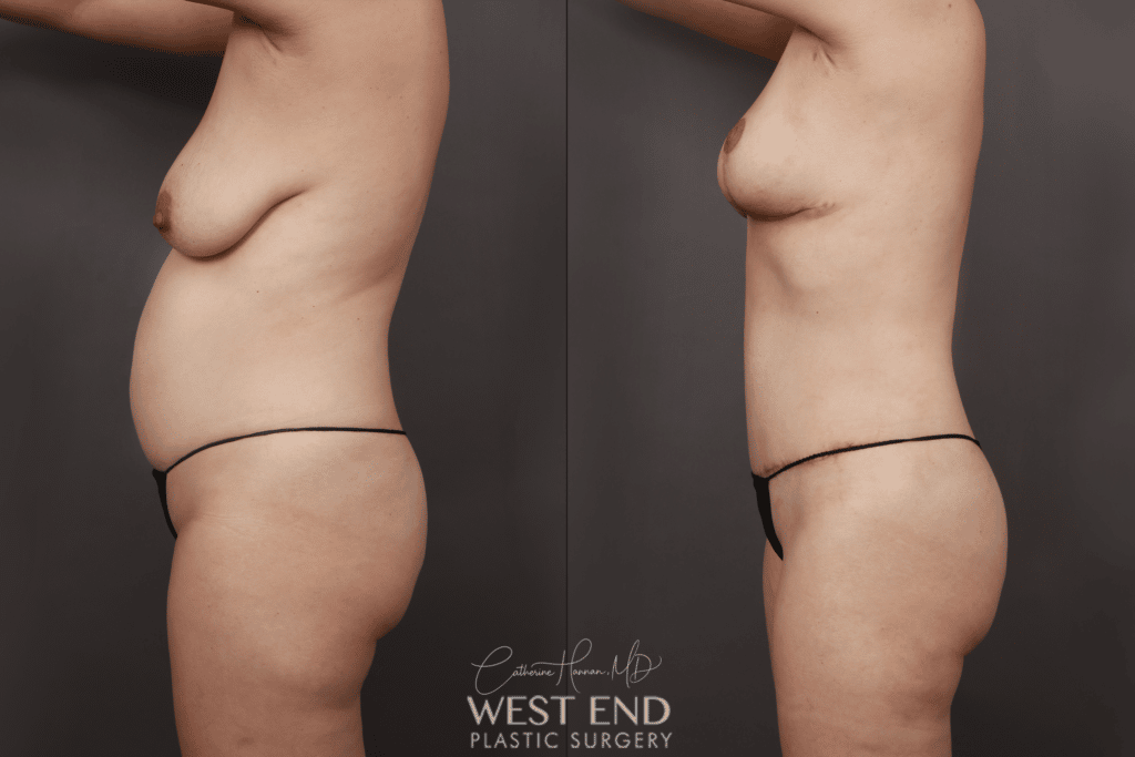 website side 1 1