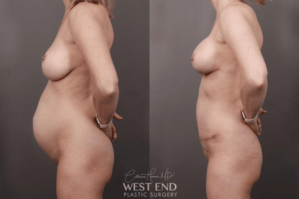 left side copy 2