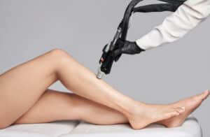 Laser Hair Removal Washington DC